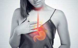 How Acid Reflux Plays a Role