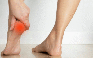 What Are Plantar Fasciitis and Thyroid Problems?